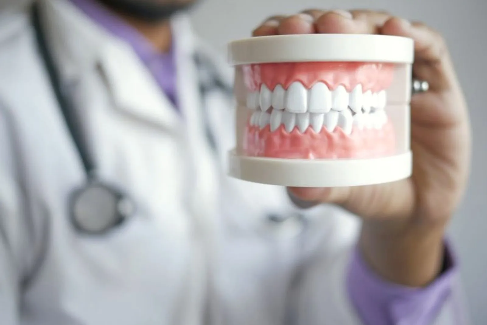 Bridge dentaire fixe prenant appui sur les dents voisines pour remplacer une dent manquante