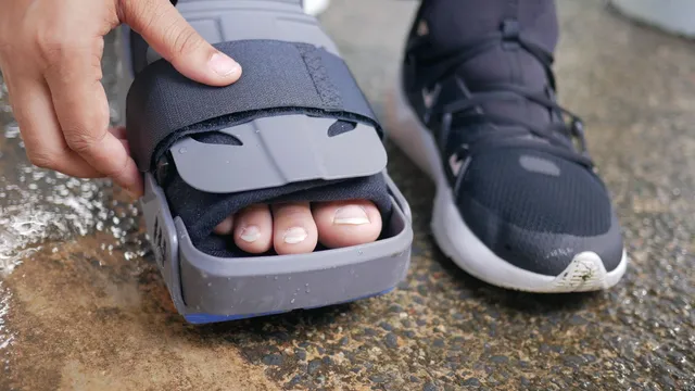 Remboursement semelle orthopédique : le reste à charge